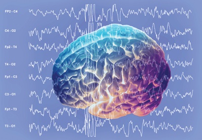 คลื่นสมอง (EEG's)